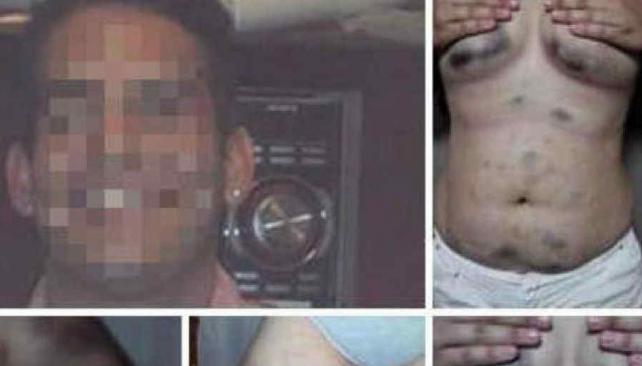 Por redes. Amigas de la víctima difundieron por Facebook el caso y mostraron imágenes de los golpes (Facebook). 